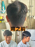 奥克斯（AUX）剃头理发器电推子成人电推剪婴儿电动剪发器家用儿童剃头刀剪头发推子剪刀理发工具套装 豪华全配款【精钢双剪+备用刀头+美发礼包】 实拍图