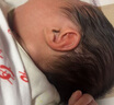 艾妮心新生婴儿儿童爱美耳夹硅胶耳廓贴非耳朵矫正器耳型环缩耳垂耳隐耳 单只B款小点+硅胶贴+1对1指导 实拍图