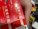 福元 红霉素软膏1% *10g消炎杀菌化脓性皮肤感染私处消肿烫伤脓包痤疮抗菌溃疡感染祛痘痤疮唇炎 实拍图