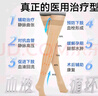 振德（ZHENDE）医用静脉曲张弹力袜 压力一级短筒露趾 静脉曲张袜 压力袜 肤色XL 实拍图