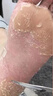 香港大药房有限公司真菌王手足癣感染皮炎湿疹脚气止瘙痒脱皮烂脚丫皮肤用抗藥抑膏 实拍图