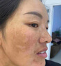 理奈日本进口美白祛斑霜斑点黑色素改善暗沉一夜消强力去除斑雀老年斑 买五送五【发十支】多买多送 实拍图