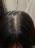 维特丝（vetes）育发液防脱发育发浓密增长液生发剂固发增长密男女头皮护理精华液 实拍图