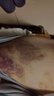 JAJALIN经络拍硅胶痧板拍棒捶背敲打器锤肩神器颈椎按摩养生专用颜色随机 实拍图