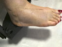 鱼跃（Yuwell）双拐YU860A老人拐杖腋下骨折医用病人手杖助行器铝合金伸缩棍加厚 实拍图