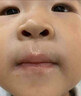 本安制药日本唇炎唇膏专用慢性嘴唇干裂脱皮慢性口角反复开裂儿童非医用级 实拍图