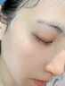 白云山壬二酸祛痘面膜10片淡化痘印控油祛痘毛孔收缩补水保湿男女士 实拍图