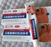 久卜制药脚气软膏药止痒脱皮烂脚丫真菌感染狼毒王喷雾剂脚臭痒克星治 1盒 实拍图