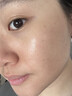 维特丝愈创木祛痘精华控油修护保湿淡化痘印去痘痘收缩毛孔男女士护肤品 实拍图
