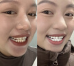 维特丝美亮白牙贴炫白牙齿去黄去渍清新口气口腔异味温和不酸牙磨牙贴片 实拍图