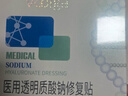 敷尔佳 医用面部修复贴透明质酸钠术后修复皮肤敷料皮肤过敏轻中度痤疮 【白膜3盒15片】术后 敏感修复 痤疮色素沉着 实拍图