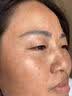 卡尼尔泰国原装进口防晒霜祛斑美白精华消除晒斑晒伤去痘印护肤品套装 实拍图