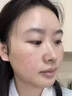去红血丝修复角质层薄敏感肌修复医用过敏皮肤脸部泛红敏感修复去除修复红血丝增厚角质层维a酸乳膏 1盒【0激素放心用】 实拍图