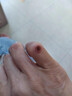 藤田制药日本鸡眼贴去根去无痛脱落肉刺刺猴连根拔跖疣脚底趾疣专用1盒 实拍图