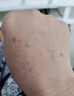 东田老年斑专用的膏药一夜消脸部手背祛斑专用霜去老人斑强力除男士液 【1盒装】特效膏 美白祛斑霜淡化黑色素黄褐斑雀斑晒斑女士用的中药 实拍图