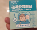 Care1st嘉卫士婴儿耳朵固定贴 垂耳纠正定型 耳廓硅胶贴新生儿适用60cm 实拍图