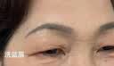 TANZI院线级810拉杆箱脱毛仪冰点激光脱毛光子嫩肤爆款家用美容院仪器 升级款【双风扇】银色 八靶条 实拍图