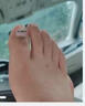 Dr.JYS甲沟炎矫正器钛合金硅胶款指甲长肉里嵌甲专用正甲贴片 实拍图