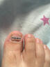Dr.JYS甲沟炎矫正器镍钛合金正甲贴片嵌甲专用脚趾甲长肉里足部固定器 实拍图