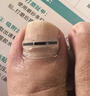 脚医生足部固定器甲沟炎矫正器嵌甲专用正甲贴片脚趾甲长肉里 实拍图