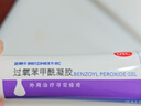 【原研好药】班赛 过氧苯甲酰凝胶5%（15g：0.75g）* 15g 医用祛痘消炎药膏去痤疮粉刺消红肿痘痘药法国进口 实拍图