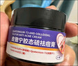 德德维芙（DETVFO）皮傲宁胶态硫祛痘膏壬二酸去痘痘淡化痘印坑痘疤修复粉刺闭口30g 实拍图