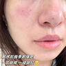 OHBT377美白补水喷雾小分子爽肤水保湿抗皱紧致湿敷精华男女护肤化妆 实拍图