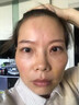 脸部凹陷填充液胶原蛋白太阳穴泪沟眼窝凹陷填充神器面部修复精华 买2送1【三天变圆脸】 实拍图