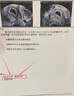 本桑制药辅助备孕贴暖宫贴调理宫寒月经量少卵巢早衰备孕女性专用贴 实拍图