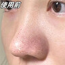 同仁堂（TRT）去黑头修复毛孔收缩毛孔撕拉面膜毛孔粗大粉刺去黑头鼻贴男女士 实拍图