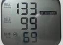 欧姆龙（OMRON）电子血压计血压仪家用医用 锂电池充电 老人HEM-7522  实拍图