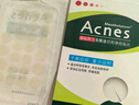 曼秀雷敦（Mentholatum）乐肤洁隐形痘痘贴遮瑕抗痘祛痘日夜双效52片吸脓隐形女生约会神器 实拍图