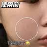 海洋主义 SOCUS维A酸乳膏尿素维E软膏关节手肘脖子暗沉去鸡皮官方正品淡化老年斑 30g 2支 维A焕肤乳膏+维E乳膏尿素 早晚搭配 揉出润滑晶莹美肌 实拍图