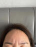 EDRI川字纹贴抬头纹去除神器男重度额头皱纹睡觉贴提拉紧致抗皱女专用 实拍图