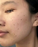 纽利安（Newliann）点痣膏去痣修复液脸部点疣药水祛斑疤痕无痕美容院专用官方正品 实拍图