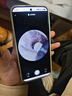 bebird 蜂鸟智能可视挖耳勺洁耳仪采耳镊子掏耳朵神器 Note5 Pro 星空蓝 实拍图