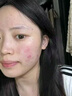 维特丝愈创木祛痘精华控油修护保湿淡化痘印去痘痘收缩毛孔男女士护肤品 实拍图