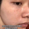 透真377美白祛斑淡化黑色素雀斑抗皱紧致淡纹面部玫瑰精华油去黄次抛 实拍图