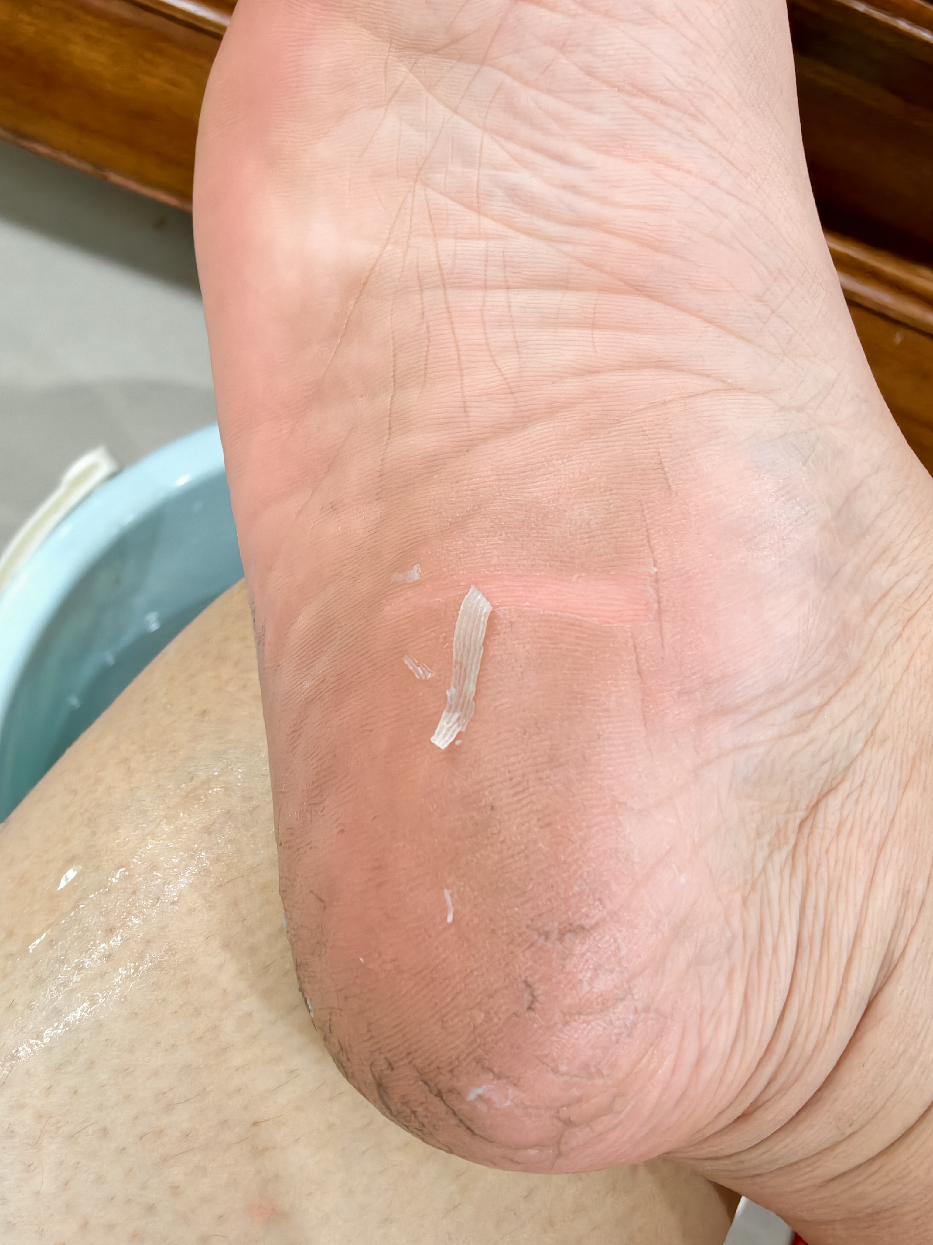咪一喵（miimeow）日本咪一喵去死皮脚膜脚后跟干裂老茧脱皮去角质足膜男女足部护理 乳酸足膜2片*1袋 实拍图