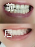 DR.NOELLE 诺艾尔博士口臭漱口水去口臭杀菌防蛀清新口气牙结石溶解洗牙垢牙黄牙渍清理 1瓶【300ml】 晒单实拍图