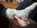 Olera儿童护踝运动扭伤医用级康复护脚踝固定支具专业防崴跟腱骨折护具 实拍图
