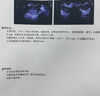 本桑制药辅助备孕贴暖宫贴调理宫寒月经量少卵巢早衰备孕女性专用贴 实拍图