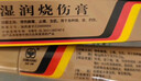 [美宝] 湿润烧伤膏 20g/支*2盒 实拍图