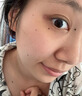 纽利安（Newliann）点痣膏去痣修复液脸部点疣药水祛斑疤痕无痕美容院专用官方正品 实拍图