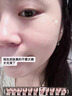 医用精华液械字号收缩毛孔粗大修复细致去黑头粉刺闭口男士女士祛痘印黑色素沉淀控油淡化痘印痘坑透明质酸钠 实拍图