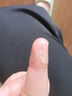脚医生甲沟隔离垫非甲沟炎正甲贴片矫正器嵌甲纠正填充垫片趾甲往肉里长 实拍图