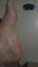 神奇 珊瑚癣净 250mI/瓶 治脚气药止痒脱皮烂脚丫真菌感染自营老牌子正品去脚气泡脚专用药包除脚癣臭出汗藓 实拍图