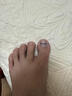 Dr.JYS甲沟炎矫正器镍钛合金正甲贴片嵌甲专用脚趾甲长肉里足部固定器 实拍图