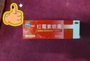 福元 红霉素软膏1% *10g消炎杀菌化脓性皮肤感染私处消肿烫伤脓包痤疮抗菌溃疡感染祛痘痤疮唇炎 实拍图