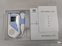CONTEC康泰胎心监测仪家用胎心监护仪 孕妇家用Sonoline C 2Mhz探头 实拍图